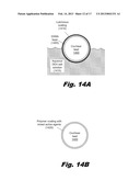 Modular Drug Delivery System for Minimizing Trauma During and After     Insertion of a Cochlear Lead diagram and image