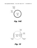 Modular Drug Delivery System for Minimizing Trauma During and After     Insertion of a Cochlear Lead diagram and image