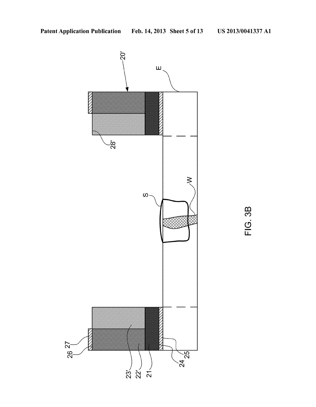 SYSTEMS AND METHODS FOR PROTECTING INCISIONS - diagram, schematic, and image 06