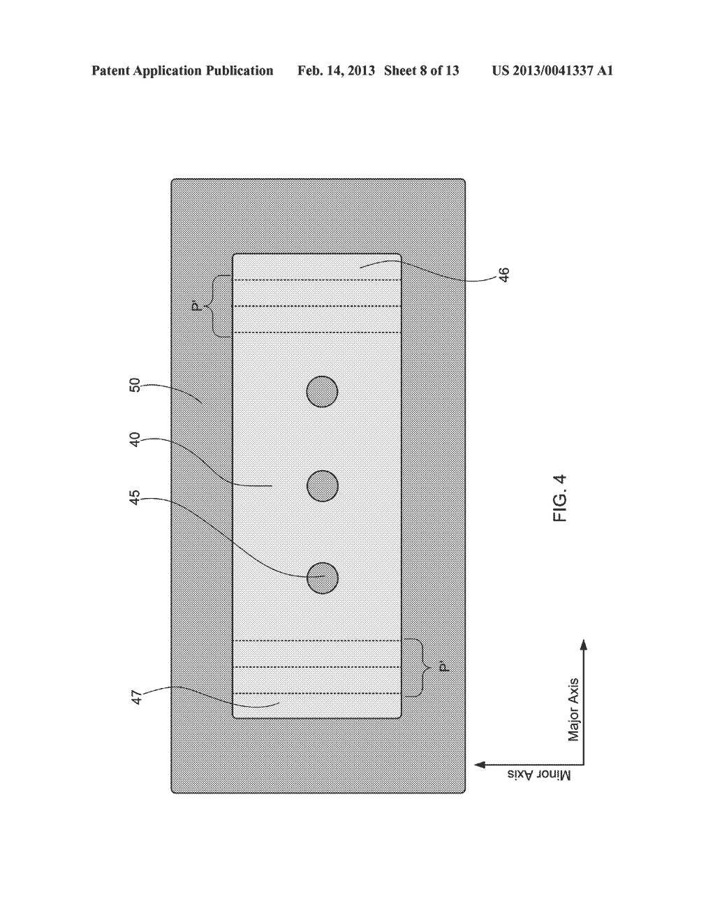 SYSTEMS AND METHODS FOR PROTECTING INCISIONS - diagram, schematic, and image 09