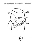 SANITARY OR INCONTINENCE PAD diagram and image