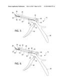 Surgical Rongeur Release Mechanism diagram and image