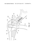 Surgical Rongeur Release Mechanism diagram and image