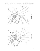 Surgical Rongeur Release Mechanism diagram and image