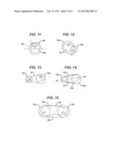 METHODS AND DEVICES FOR PREPARING AND IMPLANTING TISSUE SCAFFOLDS diagram and image