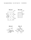 METHODS AND DEVICES FOR PREPARING AND IMPLANTING TISSUE SCAFFOLDS diagram and image