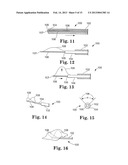 APPARATUS AND METHODS FOR INTERNAL SURGICAL PROCEDURES diagram and image