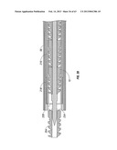 Multiple member interconnect for surgical instrument and absorbable screw     fastener diagram and image