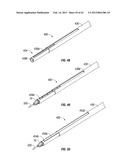 Multiple member interconnect for surgical instrument and absorbable screw     fastener diagram and image