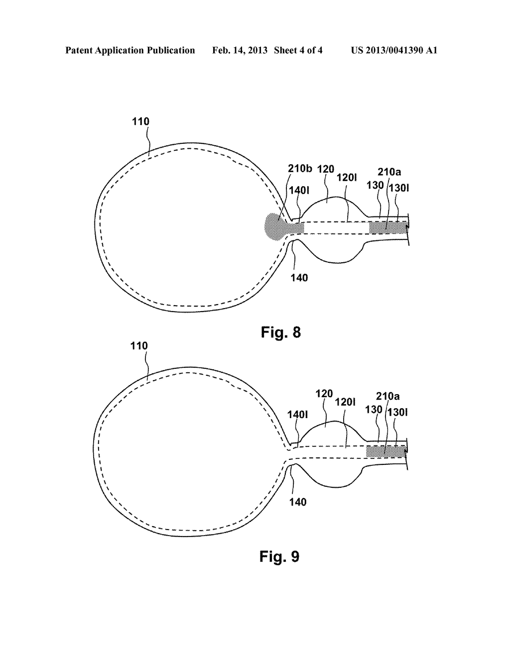 METHODS, COMPOSITIONS AND KITS FOR PERFORMING ANASTOMOSIS PROCEDURES IN     CONJUNCTION WITH A RADICAL PROSTATECTOMY PROCEDURE - diagram, schematic, and image 05