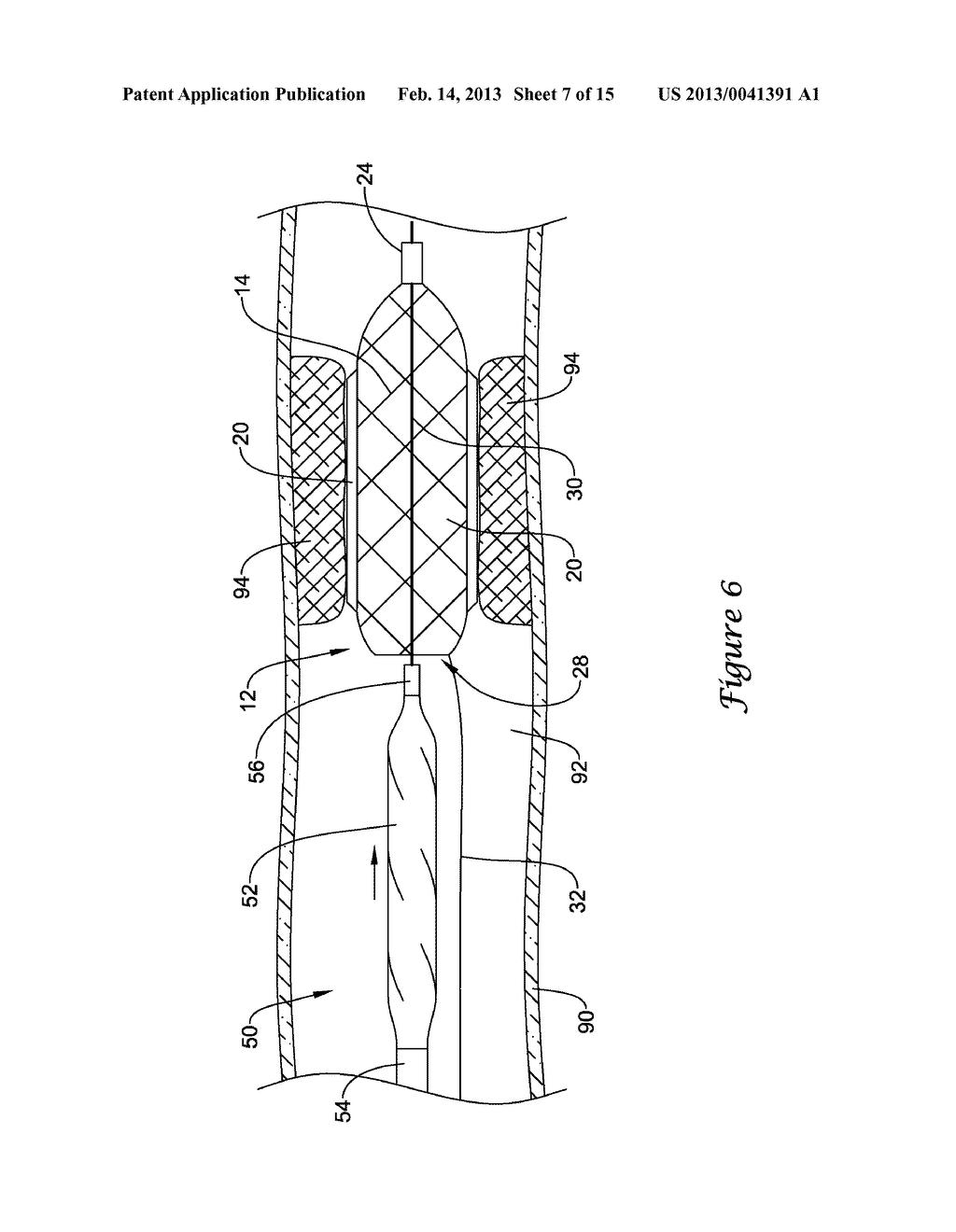 EXPANDABLE SCAFFOLD WITH CUTTING ELEMENTS MOUNTED THERETO - diagram, schematic, and image 08