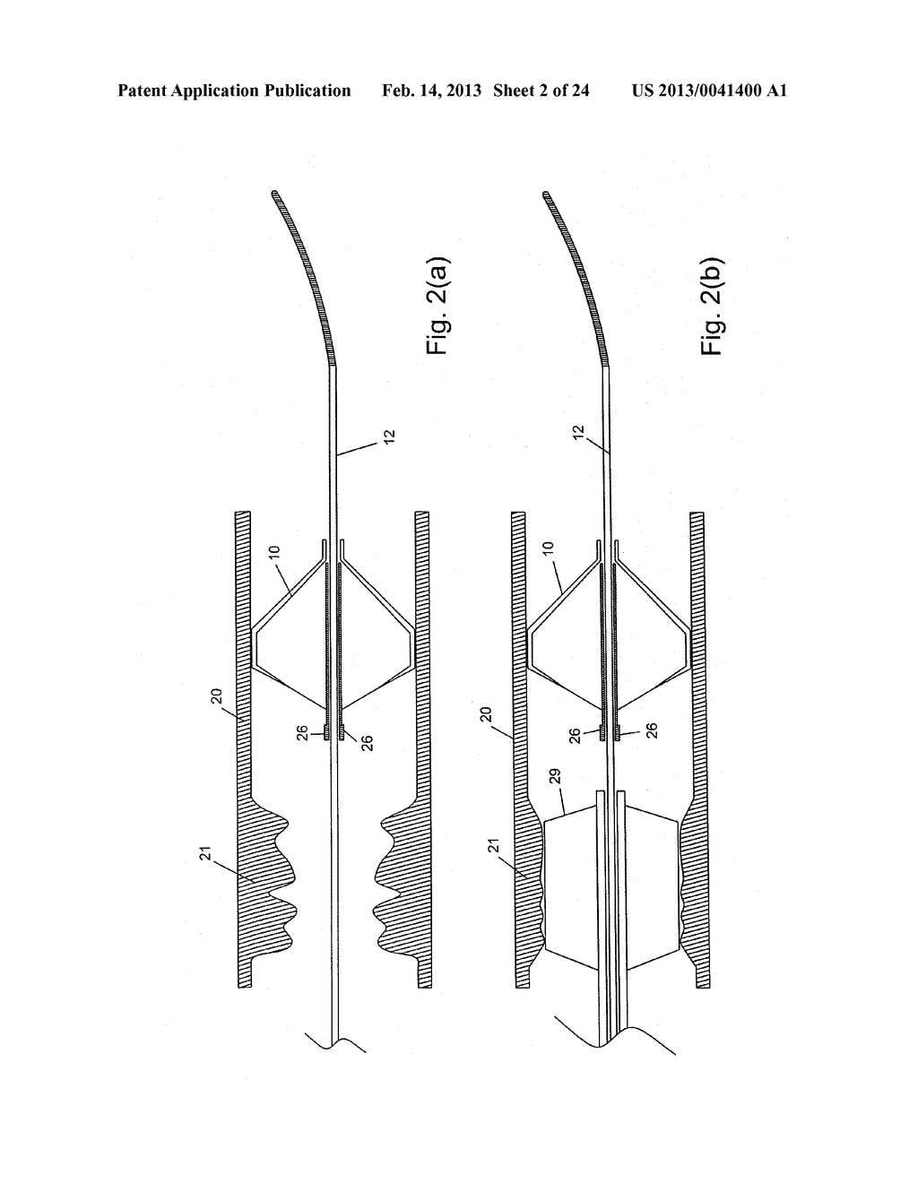 EMBOLIC PROTECTION SYSTEM - diagram, schematic, and image 03