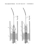 EMBOLIC PROTECTION SYSTEM diagram and image