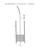 EMBOLIC PROTECTION SYSTEM diagram and image