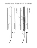 EMBOLIC PROTECTION SYSTEM diagram and image