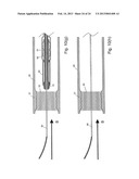 EMBOLIC PROTECTION SYSTEM diagram and image