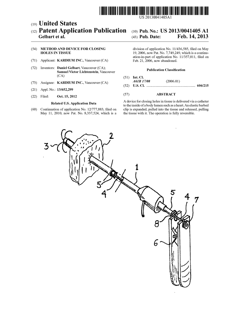 METHOD AND DEVICE FOR CLOSING HOLES IN TISSUE - diagram, schematic, and image 01