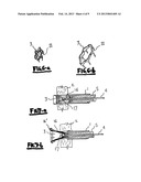 METHOD AND DEVICE FOR CLOSING HOLES IN TISSUE diagram and image