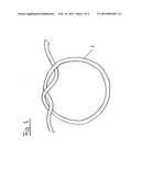 CHITOSAN FIBER diagram and image