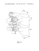 APPARATUS FOR STABILIZING VERTEBRAL BODIES diagram and image