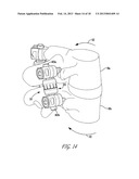 APPARATUS FOR STABILIZING VERTEBRAL BODIES diagram and image