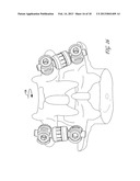 APPARATUS FOR STABILIZING VERTEBRAL BODIES diagram and image