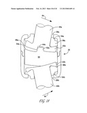 APPARATUS FOR STABILIZING VERTEBRAL BODIES diagram and image