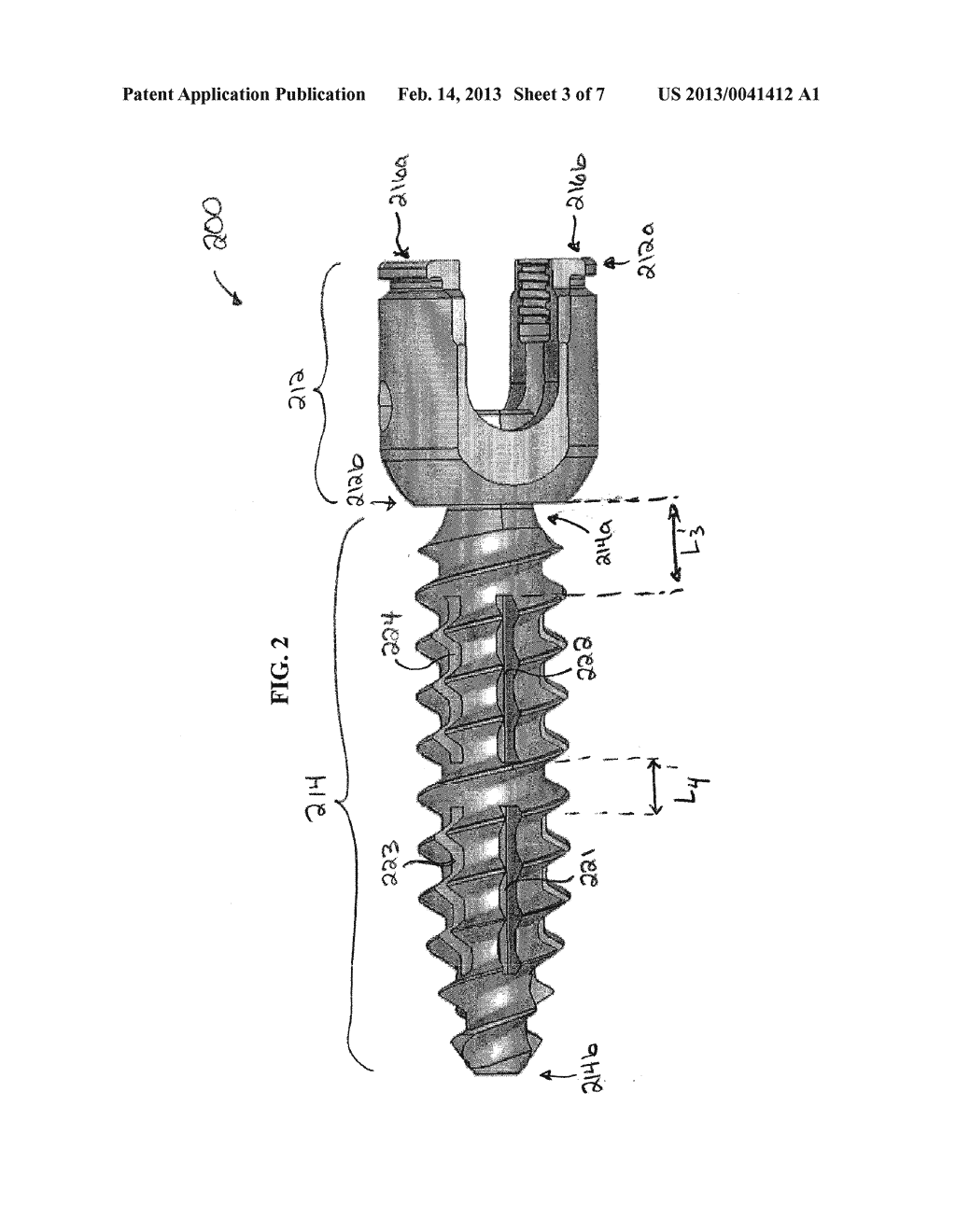 FLEXIBLE PEDICLE SCREWS - diagram, schematic, and image 04