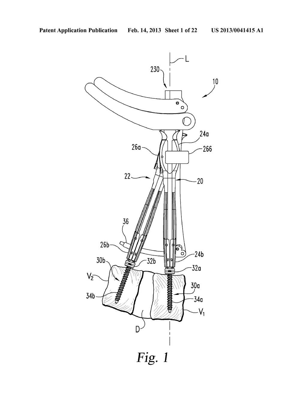 Systems and Methods for Minimally Invasive Surgical Procedures FO Systems - diagram, schematic, and image 02