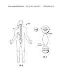 DUODENAL STIMULATION TO INDUCE SATIETY diagram and image