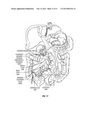 DUODENAL STIMULATION TO INDUCE SATIETY diagram and image