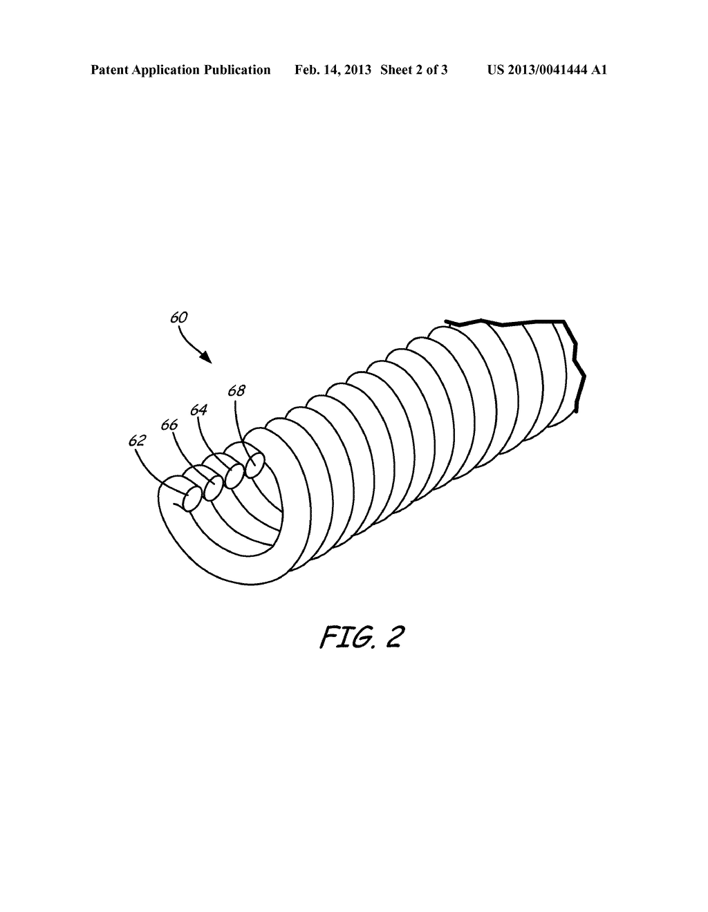 MEDICAL DEVICE LEAD WITH CONDUCTOR FRACTURE PREDICTION - diagram, schematic, and image 03