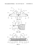 PROSTHESIS DEPLOYMENT SYSTEM FOR OPEN SURGICAL REPAIR diagram and image