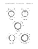 PROSTHESIS DEPLOYMENT SYSTEM FOR OPEN SURGICAL REPAIR diagram and image