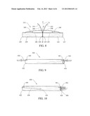 PROSTHESIS DEPLOYMENT SYSTEM FOR OPEN SURGICAL REPAIR diagram and image