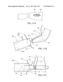 PROSTHESIS DEPLOYMENT SYSTEM FOR OPEN SURGICAL REPAIR diagram and image