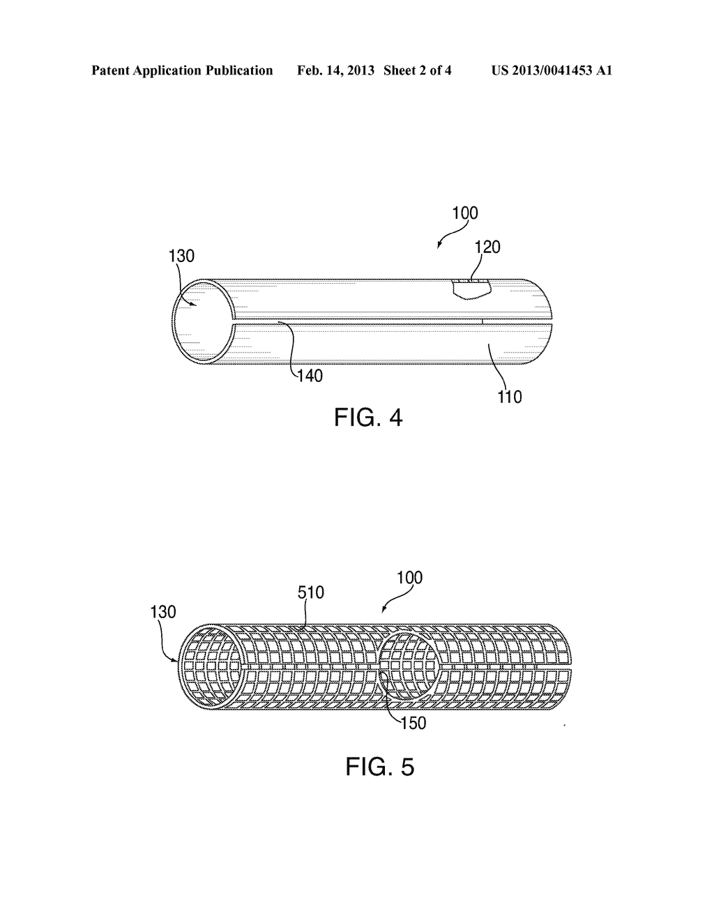 Vascular Shield and Delivery System - diagram, schematic, and image 03