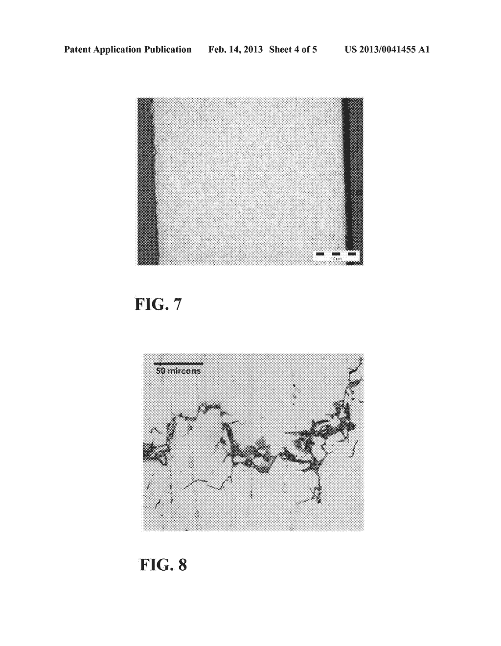 IMPLANT MADE OF A BIODEGRADABLE MAGNESIUM ALLOY - diagram, schematic, and image 05