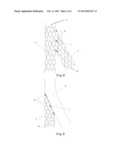 STENT FOR  BIFURCATED VESSEL diagram and image