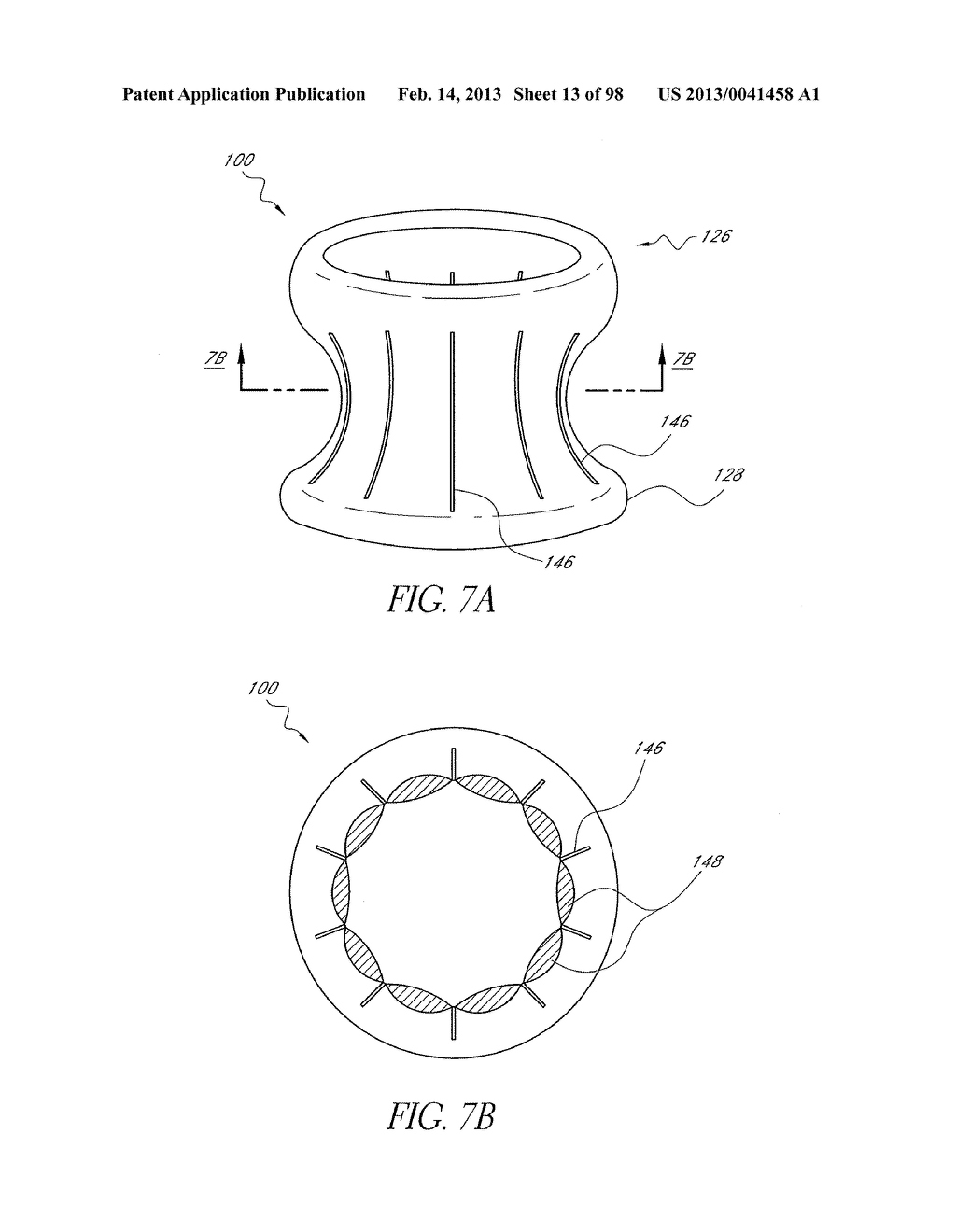 METHOD OF IN SITU FORMATION OF TRANSLUMENALLY DEPLOYABLE HEART VALVE     SUPPORT - diagram, schematic, and image 14