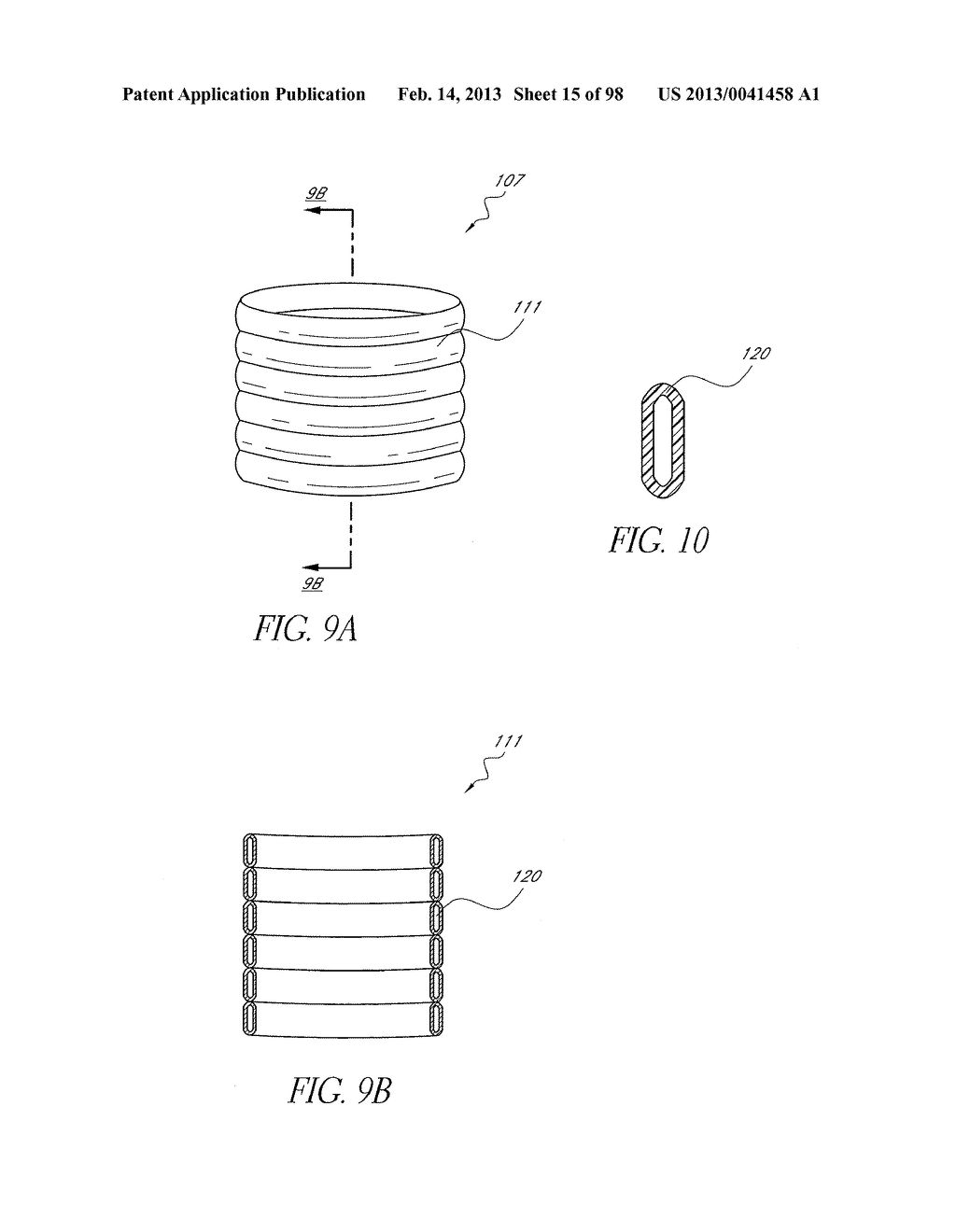 METHOD OF IN SITU FORMATION OF TRANSLUMENALLY DEPLOYABLE HEART VALVE     SUPPORT - diagram, schematic, and image 16