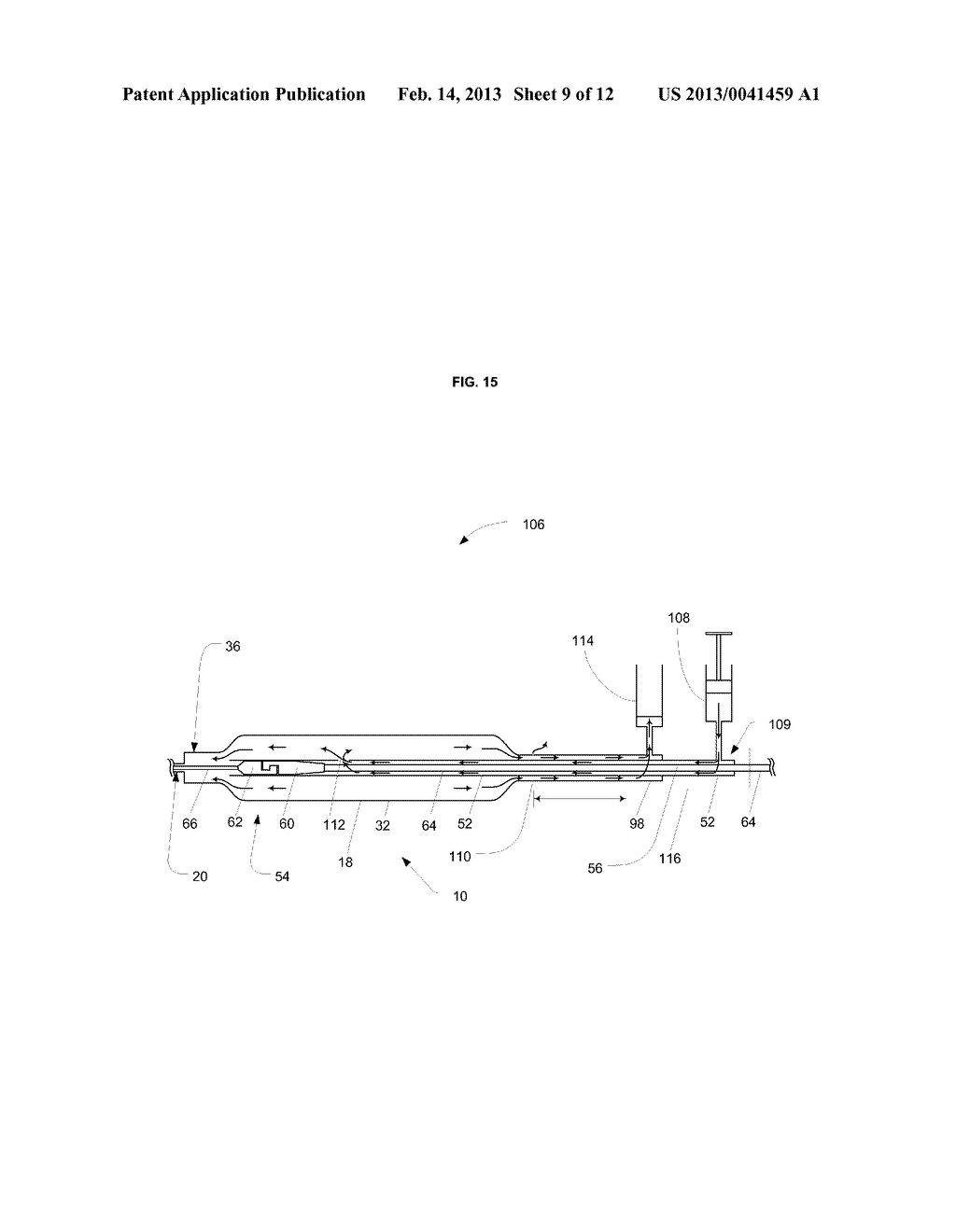 Implant Delivery and Deployment System and Method - diagram, schematic, and image 10