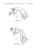 POSITIONING SYSTEMS AND METHODS FOR IMPLANTING AN ENERGY ABSORBING SYSTEM diagram and image