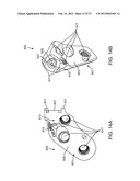 POSITIONING SYSTEMS AND METHODS FOR IMPLANTING AN ENERGY ABSORBING SYSTEM diagram and image