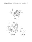 POSITIONING SYSTEMS AND METHODS FOR IMPLANTING AN ENERGY ABSORBING SYSTEM diagram and image