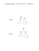 Systems and Methods for Joint Stabilization diagram and image