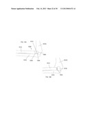 Systems and Methods for Joint Stabilization diagram and image