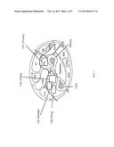 ARTIFICIAL BODY PART CONTROL SYSTEM USING ULTRASOUNIC IMAGING diagram and image