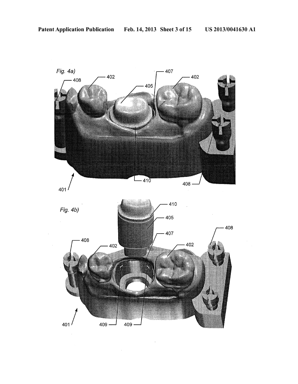 SUPPORT OF REMOVABLE COMPONENTS IN A TEETH MODEL MANUFACTURED BY MEANS OF     CAM - diagram, schematic, and image 04