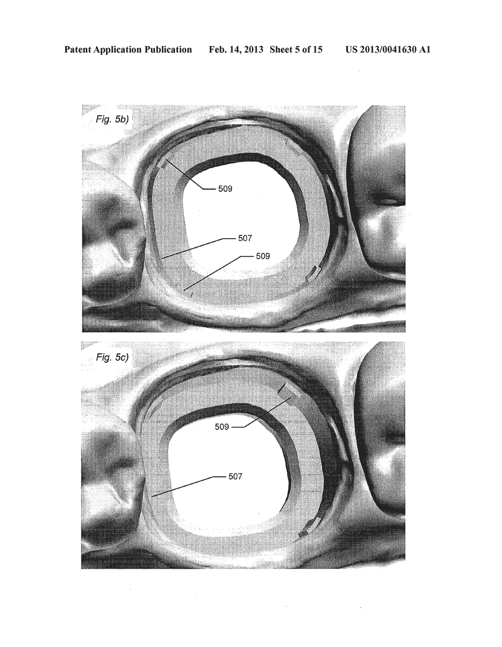 SUPPORT OF REMOVABLE COMPONENTS IN A TEETH MODEL MANUFACTURED BY MEANS OF     CAM - diagram, schematic, and image 06